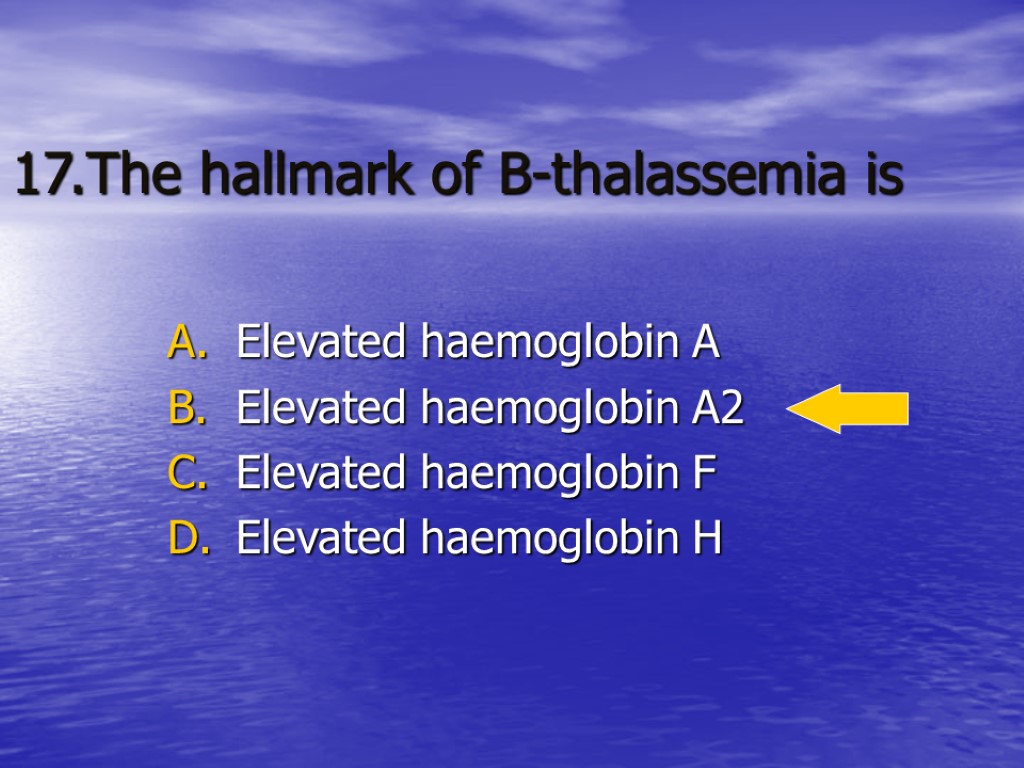 17.The hallmark of B-thalassemia is Elevated haemoglobin A Elevated haemoglobin A2 Elevated haemoglobin F